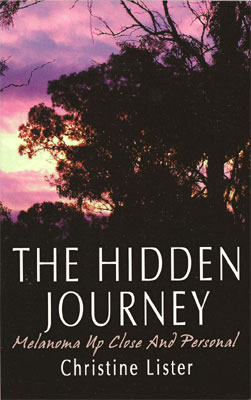 The Hidden Journey Melanoma Up Close and Personal